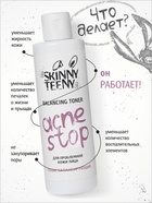 Тоник балансирующий Skinny Teeny для проблемной кожи лица, 195 мл - Фото 2