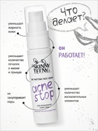 Крем дневной матирующий Skinny Teeny для проблемной кожи лица, 30 мл - Фото 2