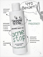 Гель для душа Skinny Teeny для проблемной кожи тела, 195 мл 10897853 - фото 16591282