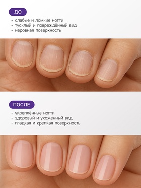 Лак-средство лечебная серия JEANMISHEL антигрибок, 6 мл