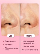 Пилинг-скатка для лица SEMILY с фруктовыми кислотами, мягкое отшелушивание, 75 мл - Фото 3