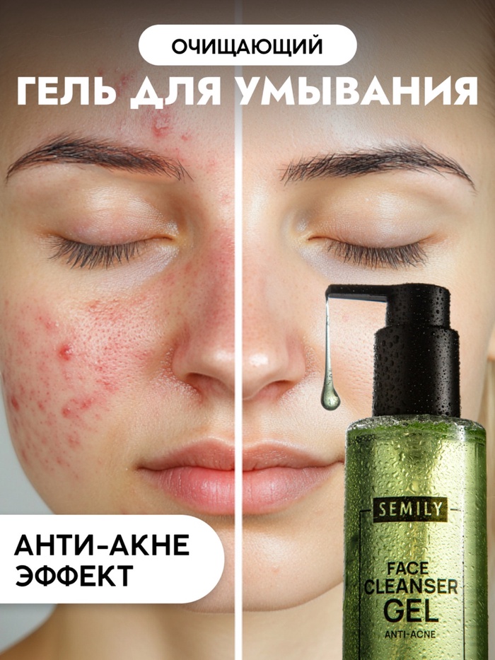 Гель для умывания очищающий SEMILY против акне, 200 мл - Фото 1