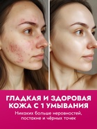 Пенка для умывания отшелушивающая SEMILY с кислотами, 150 мл - Фото 6