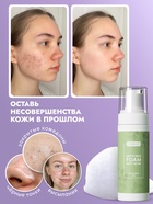 Пенка для умывания матирующая SEMILY против акне, для проблемной кожи, 150 мл - Фото 5