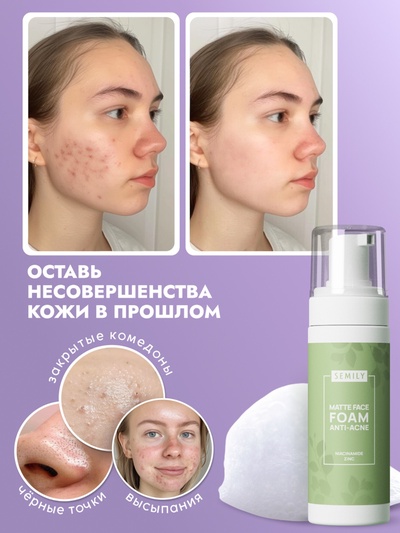 Пенка для умывания матирующая SEMILY против акне, для проблемной кожи, 150 мл