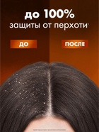 Шампунь для волос против перхоти "Клиар" защита от выпадения волос, 1000 мл - Фото 5