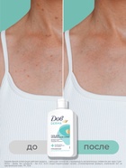 Гель для душа и умывания «Дав», для проблемной кожи, 280 мл - Фото 3