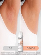 Дезодорант женский «Дав», гипоаллергенный, сенситив, 150 мл - Фото 4