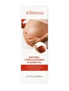 Масло от растяжек Kormesic, 30 мл  (артикул 10953378)  большой выбор товаров оптом и в розницу по низким ценам с доставкой