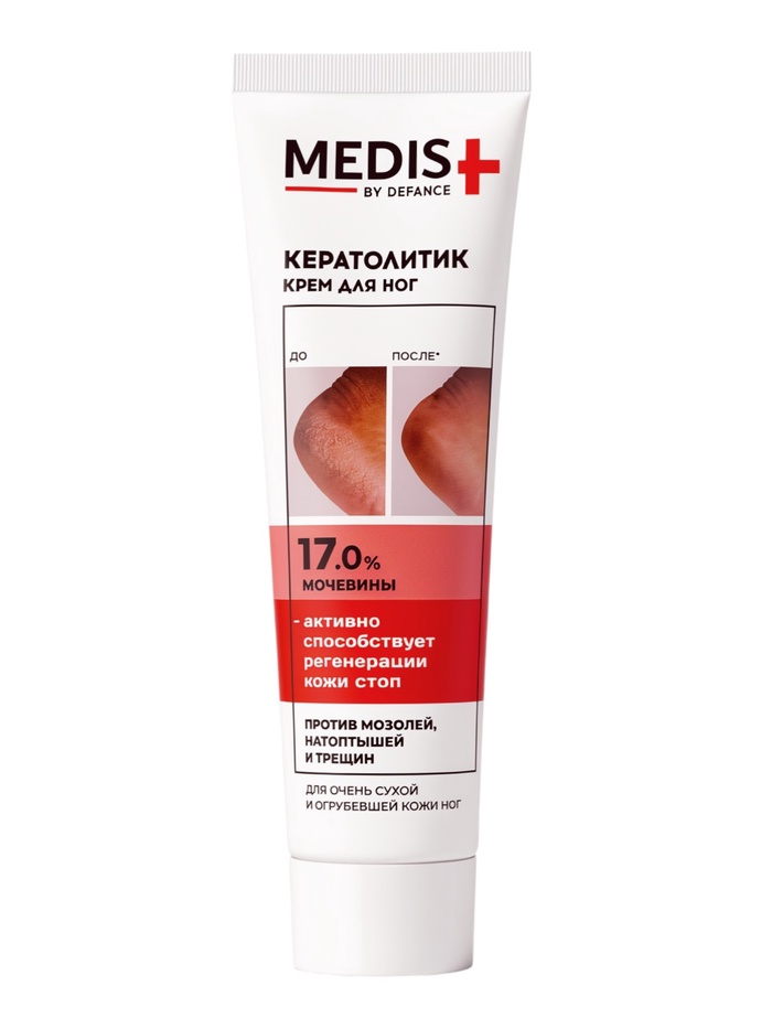 Крем кератолитик для ног DEFANCE MEDIS, против трещин, натоптышей и ороговевшей кожи, 100 мл - Фото 1
