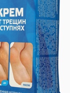 УЦЕНКА Крем для ног «До и После» от трещин в ступнях, 150 мл - Фото 7