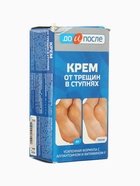 УЦЕНКА Крем для ног «До и После» от трещин в ступнях, 150 мл - Фото 2