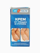 УЦЕНКА Крем для ног «До и После» от трещин в ступнях, 150 мл - Фото 3