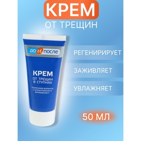 УЦЕНКА Крем для ног от трещин в ступнях, "До и После", 50 мл 11025165