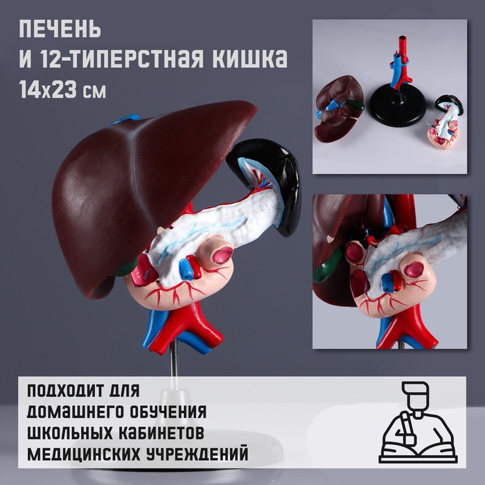 УЦЕНКА Макет "Печень и 12-типерстная кишка" 14*23см - Фото 1