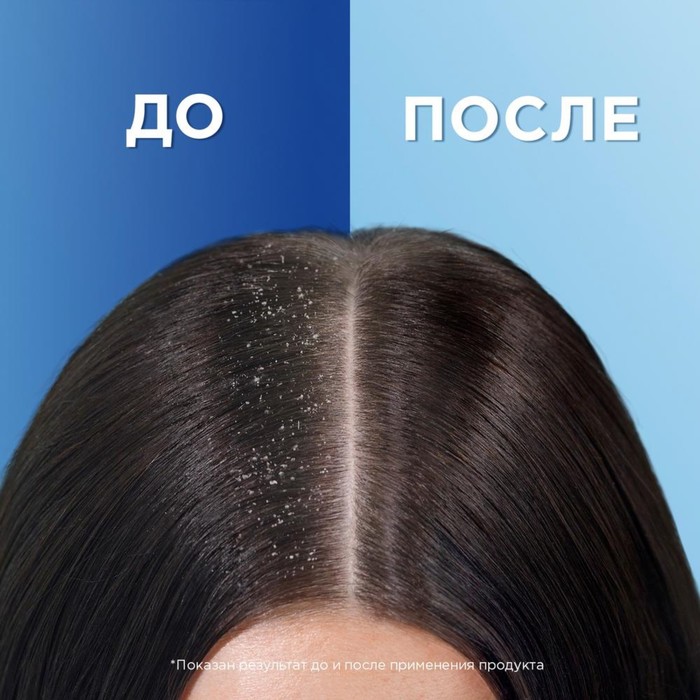 Шампунь от перхоти Head & Shoulders Ментол Ощущение ледяной свежести, 400 мл 13467
